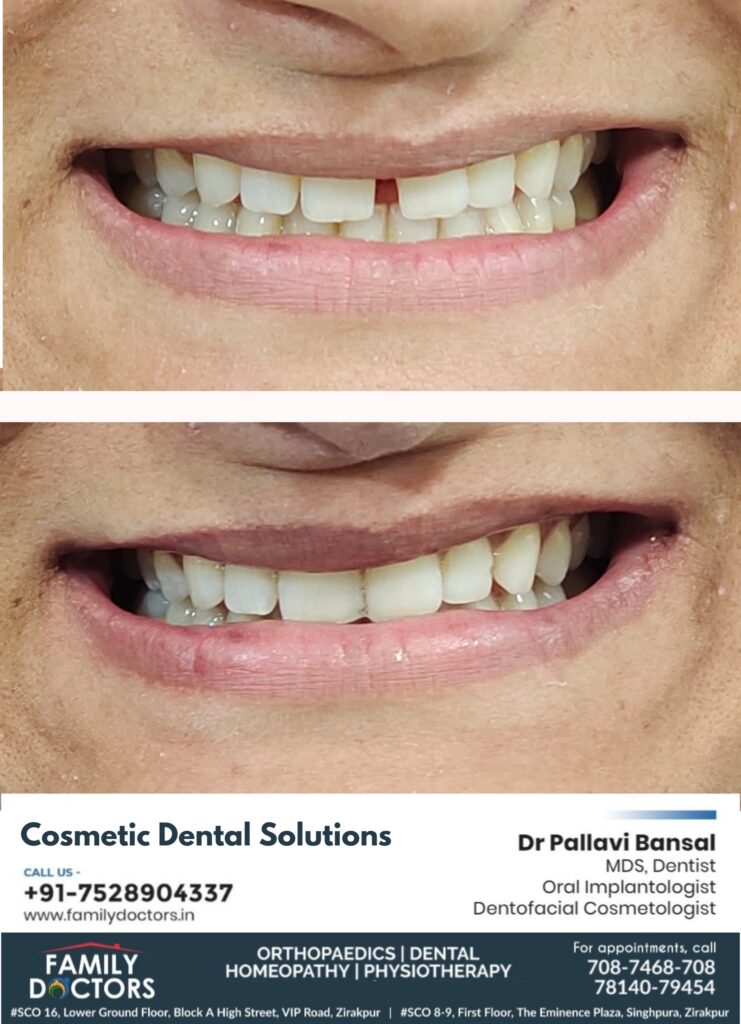 Cosmetic dental solution - familydoctors
