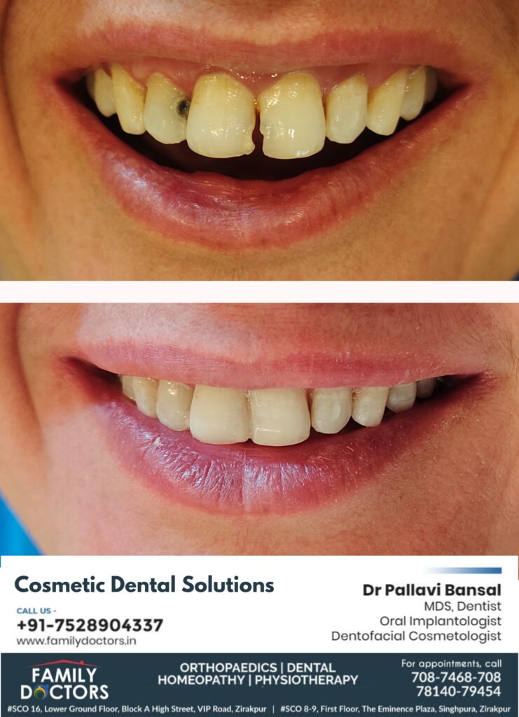 Cosmetic dental solutions