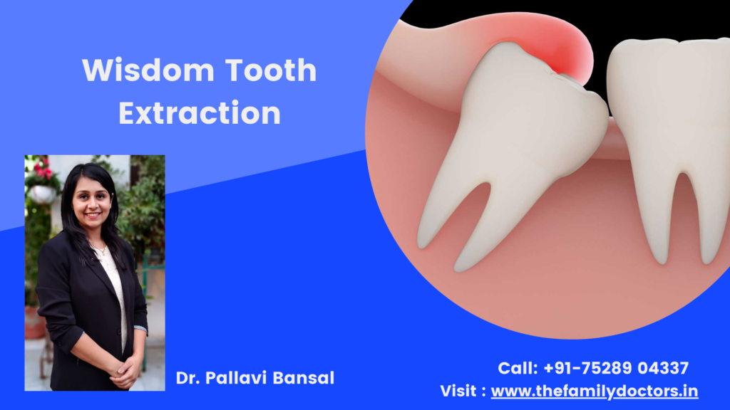 wisdom tooth extraction in zirakpur by familydoctors