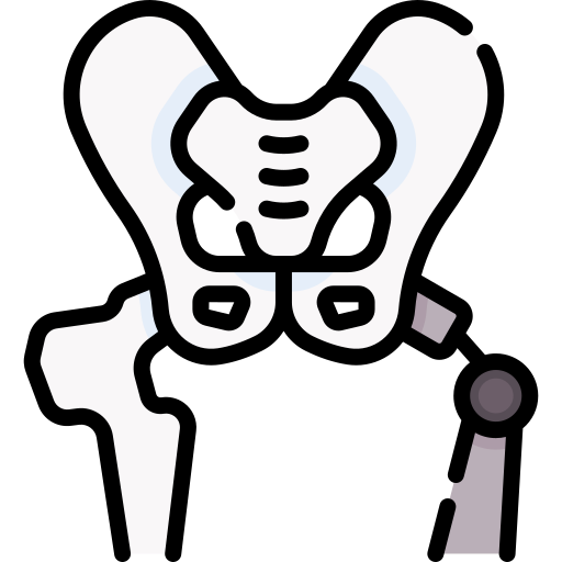 hip replacement services