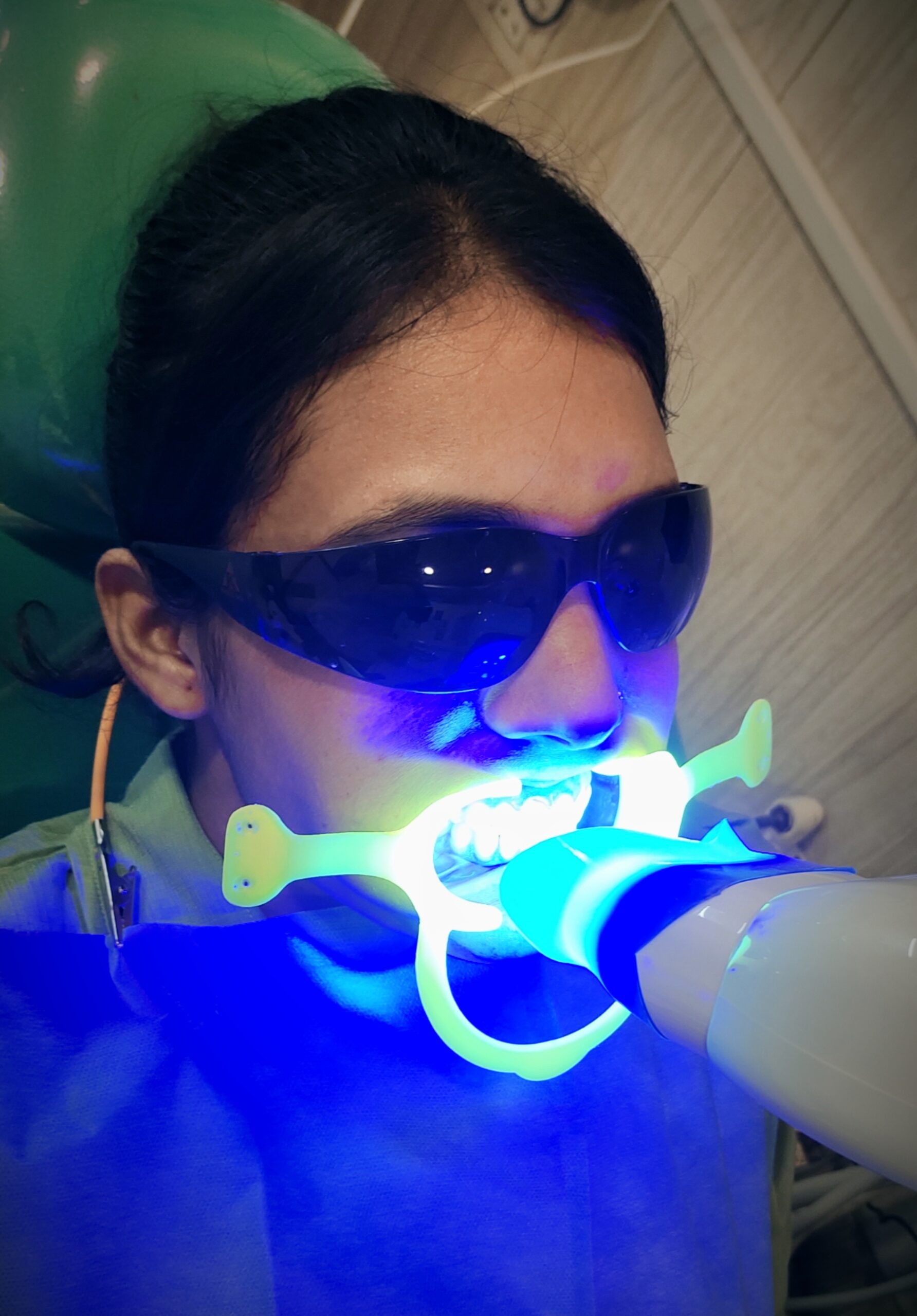 teeth whitening in zirakpur