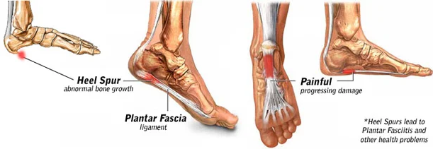 foot ankle & heel pain relief