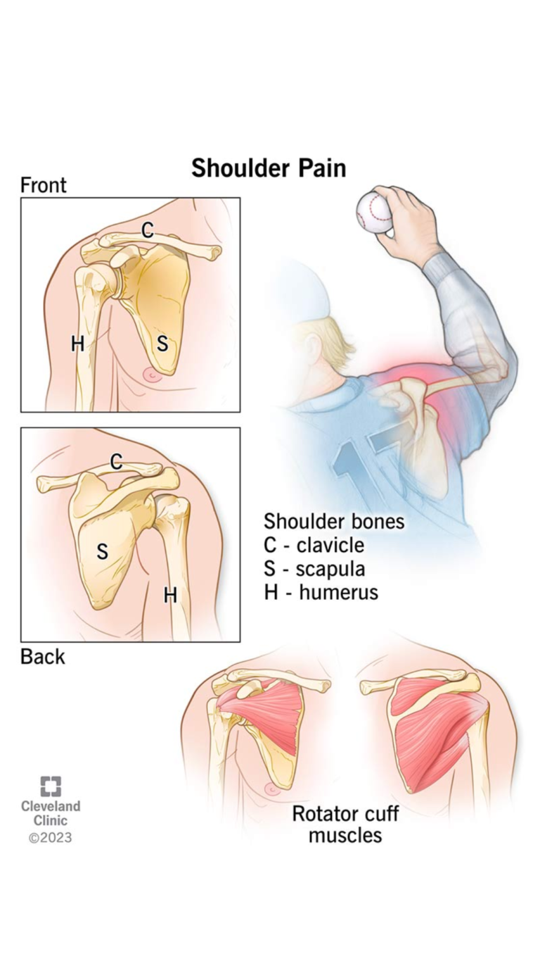 shoulder pain relief treatment in zirakpur