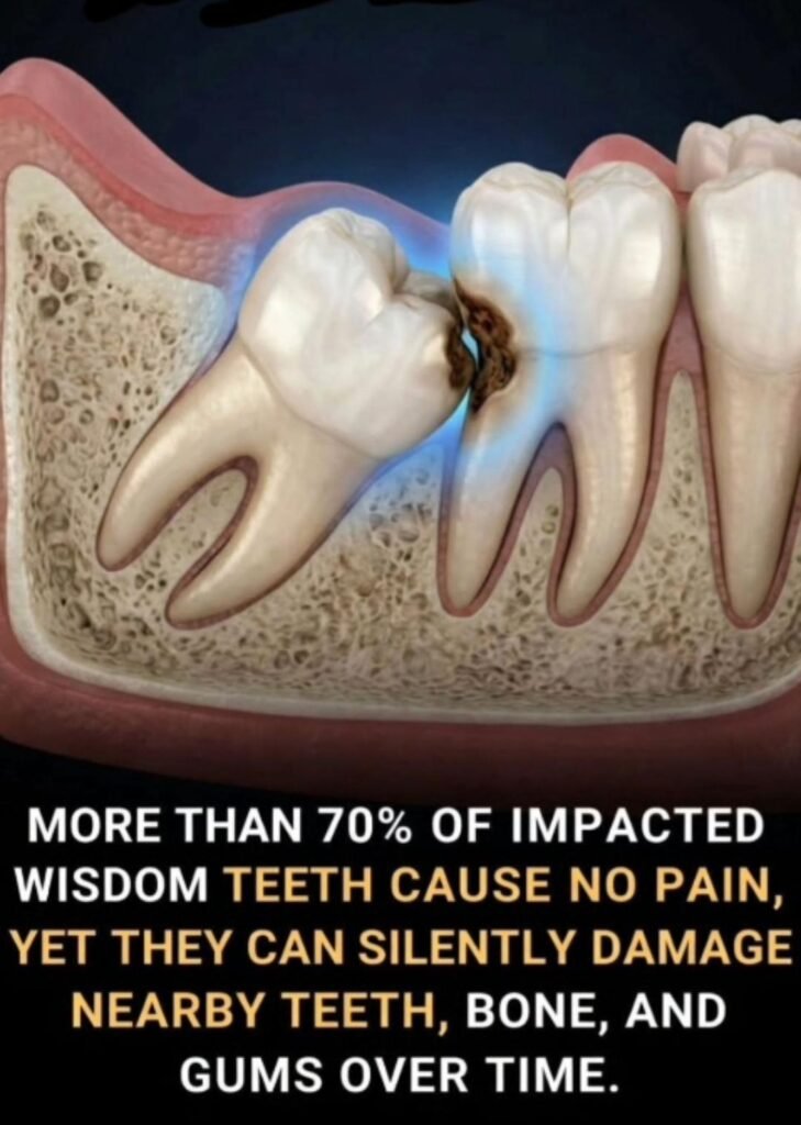 tooth wisdom