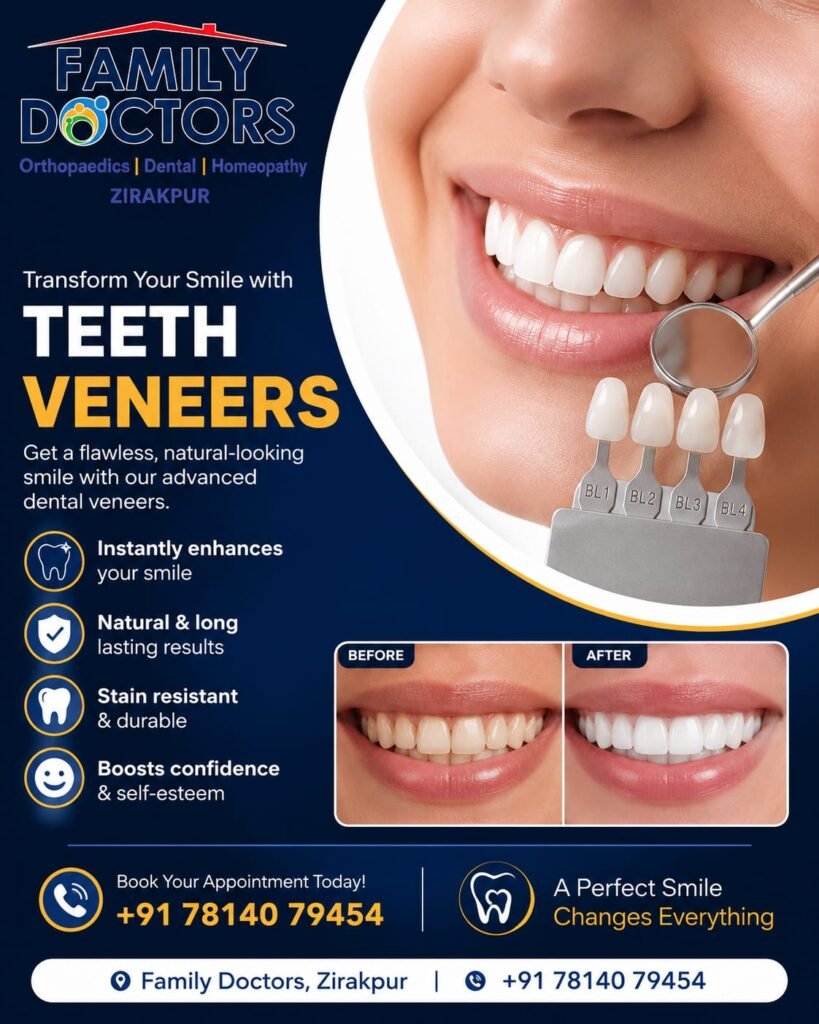 Teeth veneers treatment in zirakpur