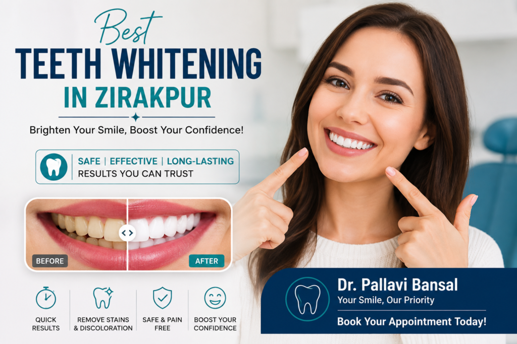 Best teeth whitening in Zirakpur