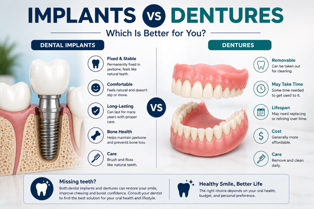 Implants vs dentures
