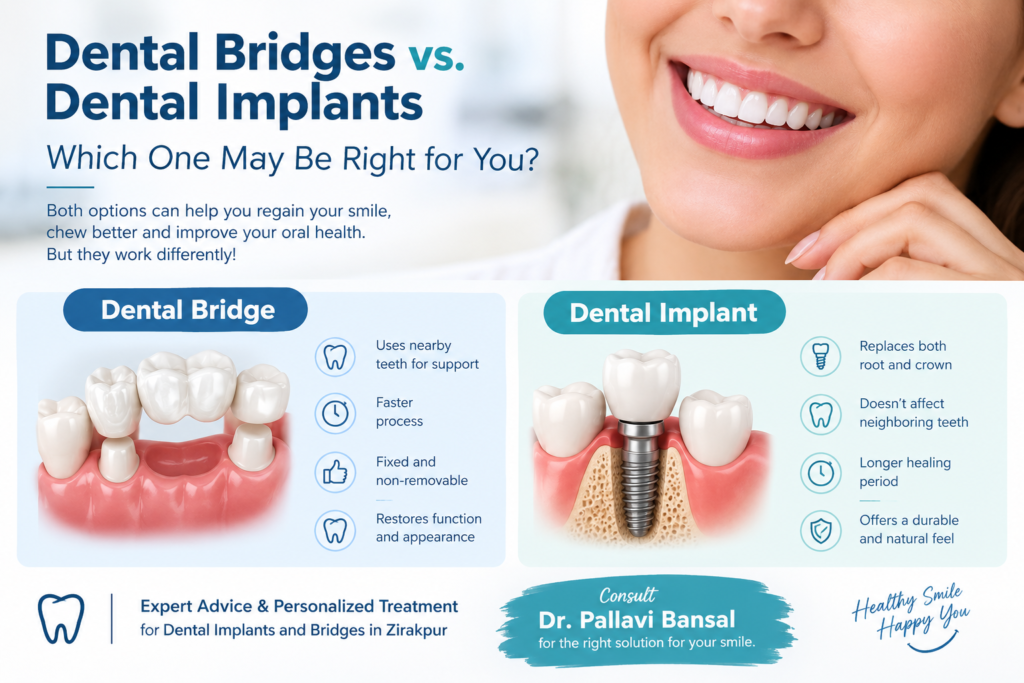 Dental Implants and Bridges in Zirakpur