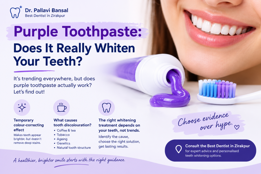 Best Dentist in Zirakpur